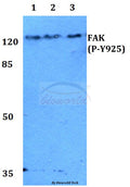Western blot (WB) analysis of p-FAK (Y925) polyclonal antibody at 1:500 dilution
Lane1:HEK293T whole cell lysate
Lane2:Raw264.7 whole cell lysate
Lane3:H9C2 whole cell lysate