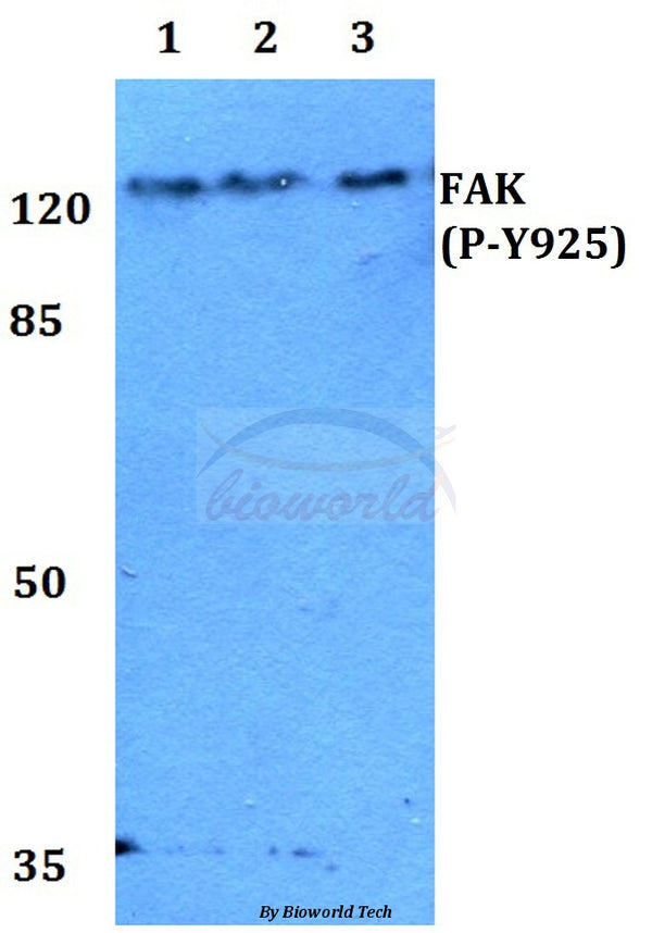 Western blot (WB) analysis of p-FAK (Y925) polyclonal antibody at 1:500 dilution
Lane1:HEK293T whole cell lysate
Lane2:Raw264.7 whole cell lysate
Lane3:H9C2 whole cell lysate