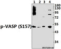 Western blot (WB) analysis of p-VASP (S157) pAb at 1:1000 dilution
Lane1:Jurkat whole cell lysate(40ug)
Lane2:K562 whole cell lysate(40ug)
Lane3:The Lung tissue lysate of Rat(40ug)
Lane4:3T3-L1 whole cell lysate(40ug)