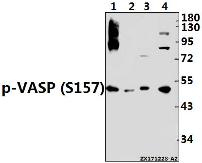 Western blot (WB) analysis of p-VASP (S157) pAb at 1:1000 dilution
Lane1:Jurkat whole cell lysate(40ug)
Lane2:K562 whole cell lysate(40ug)
Lane3:The Lung tissue lysate of Rat(40ug)
Lane4:3T3-L1 whole cell lysate(40ug)