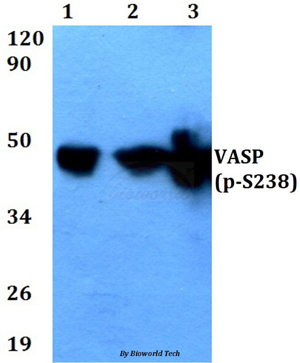 Western blot (WB) analysis of p-VASP (S238) polyclonal antibody at 1:500 dilution
Lane1:Hela cell lysate treated with forskolin (10nM, 72h)
Lane2:Raw264.7 cell lysate treated with forskolin (10nM, 72h)
Lane3:PC12 cell lysate treated with forskolin (10nM, 72h)