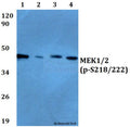 Western blot (WB) analysis of p-MEK1/2 (S218/222) polyclonal antibody at 1:500 dilution
Lane1:A549 cell lysate treated with PMA(100nM,30mins)
Lane2:Raw264.7 cell lysate treated with PMA(100nM,30mins)
Lane3:NIH-3T3 cell lysate treated with PMA(100nM,30mins)
Lane4: PC12 cell lysate treated with PMA(100nM,30mins)