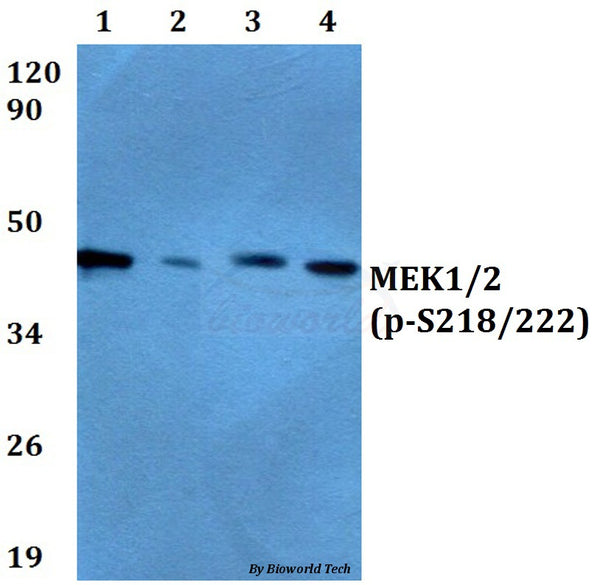 Western blot (WB) analysis of p-MEK1/2 (S218/222) polyclonal antibody at 1:500 dilution
Lane1:A549 cell lysate treated with PMA(100nM,30mins)
Lane2:Raw264.7 cell lysate treated with PMA(100nM,30mins)
Lane3:NIH-3T3 cell lysate treated with PMA(100nM,30mins)
Lane4: PC12 cell lysate treated with PMA(100nM,30mins)