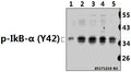 Western blot (WB) analysis of p-IkB-α (Y42) pAb at 1:500 dilution
Lane1:The Brain tissue lysate of Mouse(40ug)
Lane2:SGC7901 whole cell lysate(40ug)
Lane3:HCT116 whole cell lysate(40ug)
Lane4:MCF-7 whole cell lysate(40ug)
Lane5:Beas-2B whole cell lysate(40ug)
