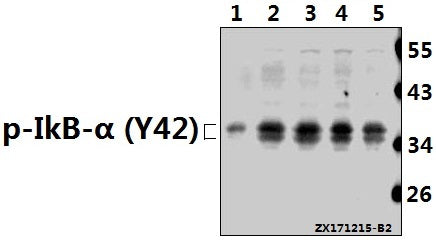 Western blot (WB) analysis of p-IkB-α (Y42) pAb at 1:500 dilution
Lane1:The Brain tissue lysate of Mouse(40ug)
Lane2:SGC7901 whole cell lysate(40ug)
Lane3:HCT116 whole cell lysate(40ug)
Lane4:MCF-7 whole cell lysate(40ug)
Lane5:Beas-2B whole cell lysate(40ug)