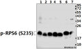 Western blot (WB) analysis of p-4E-BP1 (T46) pAb at 1:500 dilution
Lane1:PC3 whole cell lysate(40ug)
Lane2:HCT116 whole cell lysate(40ug)
Lane3:SGC7901 whole cell lysate(40ug)
Lane4:EC9706 whole cell lysate(40ug)
Lane5:Panc1 whole cell lysate(40ug)
Lane6:3T3-L1 whole cell lysate(40ug)
Lane7:PC12 whole cell lysate(20ug)