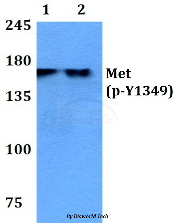 Western blot (WB) analysis of p-Met (Y1349) polyclonal antibody at 1:500 dilution
Lane1:THP-1 cell lysate treated with EGF(0.1ng/ml,30mins)
Lane2:Hela cell lysate treated with EGF(0.1ng/ml,30mins)