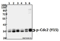 Western blot (WB) analysis of p-Cdc2 (Y15) pAb at 1:500 dilution
Lane1:MCF-7 whole cell lysate(40ug)
Lane2:HEK293T whole cell lysate(40ug)
Lane3:SGC7901 whole cell lysate(40ug)
Lane4:PC3 whole cell lysate(40ug)
Lane5:PC12 whole cell lysate(40ug)
Lane6:BV2 whole cell lysate(40ug)