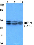 ERK 1/2 (Phospho-T202) polyclonal antibody – Figure 1 of 4