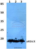 Western blot (WB) analysis of p-Histone H2A.X (S139) polyclonal antibody at 1:500 dilution
Lane1:Hela cell lysate treated with colchicine(0.2µg/ML,24h)
Lane2:sp2/0 cell lysate treated with colchicine(0.2µg/ML,24h)
Lane3:PC12 cell lysate treated with colchicine(0.2µg/ML,24h)