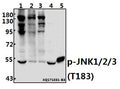 Western blot (WB) analysis of p-JNK1/2/3 (T183) pAb at 1:500 dilution
Lane1:HEK293T whole cell lysate(40ug)
Lane2:MCF-7 whole cell lysate(40ug)
Lane3:K562 whole cell lysate(20ug)
Lane4:The Brain tissue lysate of Rat(40ug)
Lane5:The Kidney tissue lysate of Mouse(20ug)