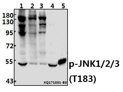 Western blot (WB) analysis of p-JNK1/2/3 (T183) pAb at 1:500 dilution
Lane1:HEK293T whole cell lysate(40ug)
Lane2:MCF-7 whole cell lysate(40ug)
Lane3:K562 whole cell lysate(20ug)
Lane4:The Brain tissue lysate of Rat(40ug)
Lane5:The Kidney tissue lysate of Mouse(20ug)