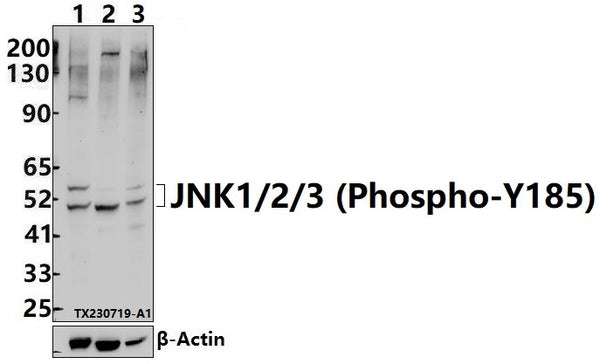 Western blot (WB) analysis of JNK1/2/3 (Phospho-Y185) polyclonal antibody at 1:5000 dilution
Lane1:HEK293T whole cell lysate(30ug)
Lane2:3T3-L1 whole cell lysate(30ug)
Lane3:PC12 whole cell lysate(30ug)