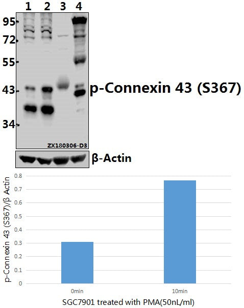 Western blot (WB) analysis of p-Connexin 43 (S367) pAb at 1:500 dilution
Lane1:SGC7901 whole cell lysate(40ug)
Lane2:SGC7901 treated with PMA(50ng/ml,10 minutes) whole cell lysate(40ug)
Lane3:The Heart tissue lysate of Mouse(40ug)
Lane4:The Testis tissue lysate of Rat(40ug)