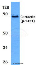 Western blot (WB) analysis of p-Cortactin (Y421) polyclonal antibody at 1:500 dilution
Lane1:Hela cell lysate treated with H2O2(100uM,15mins)