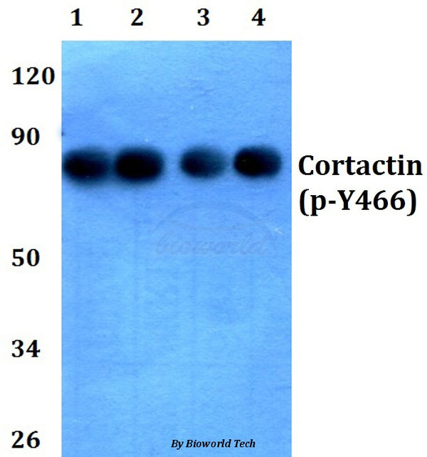 Western blot (WB) analysis of p-Cortactin (Y466) polyclonal antibody at 1:500 dilution
Lane1:HEK293T whole cell lysate
Lane2:Raw264.7 whole cell lysate
Lane3:PC12 whole cell lysate
Lane4:Hela whole cell lysate