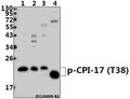 Western blot (WB) analysis of p-CPI-17 (T38) pAb at 1:500 dilution
Lane1:A549 whole cell lysate(40ug)
Lane2:HEK293T whole cell lysate(40ug)
Lane3:PC12 whole cell lysate(40ug)
Lane4:The Brain tissue lysate of Mouse(20ug)