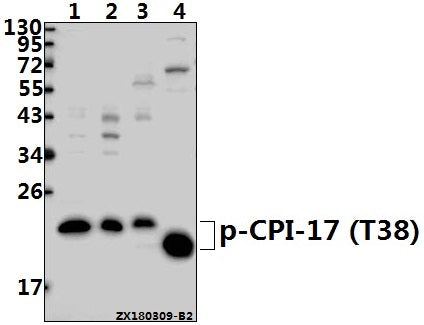 Western blot (WB) analysis of p-CPI-17 (T38) pAb at 1:500 dilution
Lane1:A549 whole cell lysate(40ug)
Lane2:HEK293T whole cell lysate(40ug)
Lane3:PC12 whole cell lysate(40ug)
Lane4:The Brain tissue lysate of Mouse(20ug)