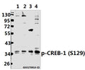 Western blot (WB) analysis of p-CREB-1 (S129) pAb at 1:500 dilution
Lane1:A375 whole cell lysate(40ug)
Lane2:MCF-7 whole cell lysate(40ug)
Lane3:The Brain tissue lysate of Rat(40ug)
Lane4:BV2 whole cell lysate(40ug)
