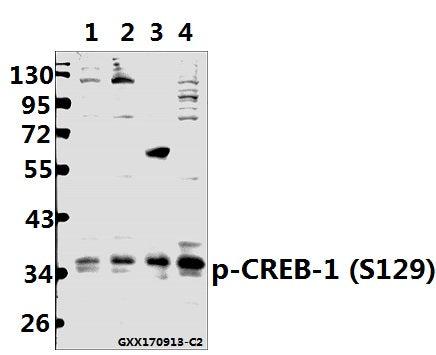 Western blot (WB) analysis of p-CREB-1 (S129) pAb at 1:500 dilution
Lane1:A375 whole cell lysate(40ug)
Lane2:MCF-7 whole cell lysate(40ug)
Lane3:The Brain tissue lysate of Rat(40ug)
Lane4:BV2 whole cell lysate(40ug)