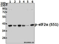 Western blot (WB) analysis of p-eIF2α (S51) pAb at 1:500 dilution
Lane1:Hela whole cell lysate(40ug)
Lane2:MCF-7 whole cell lysate(40ug)
Lane3:The Uterus tissue lysate of Rat(40ug)
Lane4:The Lung tissue lysate of Mouse(40ug)
Lane5:A2780 whole cell lysate(40ug)
Lane6:H1792 whole cell lysate(40ug)