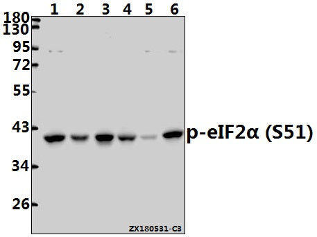 Western blot (WB) analysis of p-eIF2α (S51) pAb at 1:500 dilution
Lane1:Hela whole cell lysate(40ug)
Lane2:MCF-7 whole cell lysate(40ug)
Lane3:The Uterus tissue lysate of Rat(40ug)
Lane4:The Lung tissue lysate of Mouse(40ug)
Lane5:A2780 whole cell lysate(40ug)
Lane6:H1792 whole cell lysate(40ug)