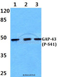Western blot (WB) analysis of p-GAP-43 (S41) polyclonal antibody at 1:500 dilution
Lane1:Hela cell lysate treated with PMA(100nM,30mins)
Lane2:Raw264.7 cell lysate treated with PMA(100nM,30mins)
Lane3:PC12 cell lysate treated with PMA(100nM,30mins)