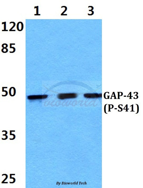 Western blot (WB) analysis of p-GAP-43 (S41) polyclonal antibody at 1:500 dilution
Lane1:Hela cell lysate treated with PMA(100nM,30mins)
Lane2:Raw264.7 cell lysate treated with PMA(100nM,30mins)
Lane3:PC12 cell lysate treated with PMA(100nM,30mins)