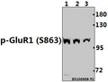 Western blot (WB) analysis of p-GluR1 (S863) pAb pAb at 1:500 dilution
Lane1:HEK293T whole cell lysate(40ug)
Lane2:K562 whole cell lysate(40ug)
Lane3:U-87MG whole cell lysate(40ug)