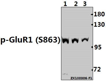 Western blot (WB) analysis of p-GluR1 (S863) pAb pAb at 1:500 dilution
Lane1:HEK293T whole cell lysate(40ug)
Lane2:K562 whole cell lysate(40ug)
Lane3:U-87MG whole cell lysate(40ug)