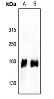 Western blot (WB) analysis of EGFR (Phospho-Tyr1110) polyclonal antibody at 1:500 dilution
LaneA:PMVEC whole cell lysate(40ug)
LaneB:HCC827 whole cell lysate(40ug)