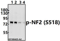 Western blot (WB) analysis of p-NF2 (S518) pAb at 1:500 dilution
Lane1:A375 whole cell lysate(40ug)
Lane2:Hela whole cell lysate(40ug)
Lane3:The Uterus tissue lysate of Rat(40ug)
Lane4:CT26 whole cell lysate(40ug)
