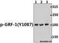 Western blot (WB) analysis of p-GRF-1 (Y1087) pAb at 1:1000 dilution
Lane1:MCF-7 whole cell lysate(40ug)
Lane2:HuT78 whole cell lysate(40ug)
Lane3:K562 whole cell lysate(40ug)
