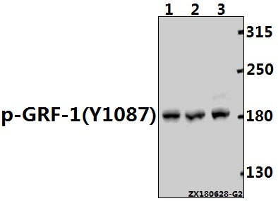 Western blot (WB) analysis of p-GRF-1 (Y1087) pAb at 1:1000 dilution
Lane1:MCF-7 whole cell lysate(40ug)
Lane2:HuT78 whole cell lysate(40ug)
Lane3:K562 whole cell lysate(40ug)