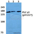 Western blot (WB) analysis of p-PLC γ2 (Y1217) polyclonal antibody at 1:500 dilution
Lane1:HEK293T cell lysate treated with EGF(0.1ng/ML,30mins)
Lane2:sp2/0 cell lysate treated with EGF(0.1ng/ML,30mins)
Lane3:H9C2 cell lysate treated with EGF(0.1ng/ML,30mins)