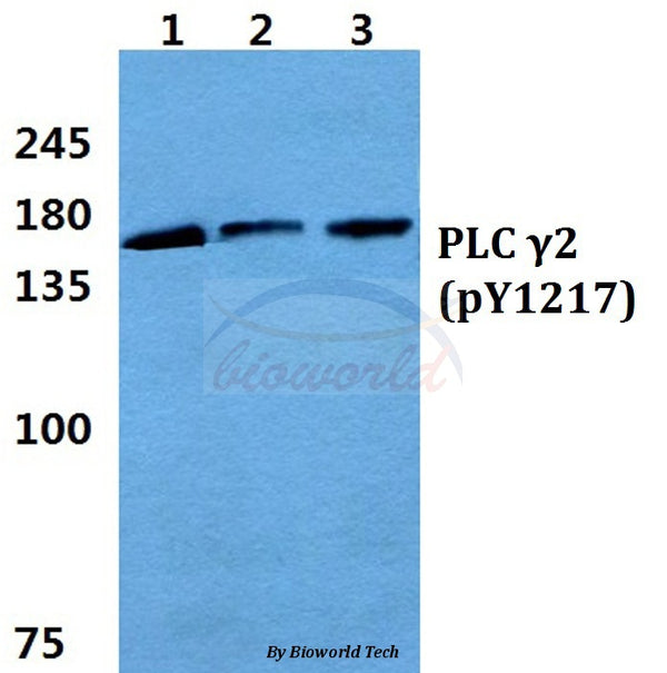 Western blot (WB) analysis of p-PLC γ2 (Y1217) polyclonal antibody at 1:500 dilution
Lane1:HEK293T cell lysate treated with EGF(0.1ng/ML,30mins)
Lane2:sp2/0 cell lysate treated with EGF(0.1ng/ML,30mins)
Lane3:H9C2 cell lysate treated with EGF(0.1ng/ML,30mins)