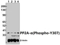 PP2A-α (Phospho-Y307) polyclonal antibody – Figure 1 of 1