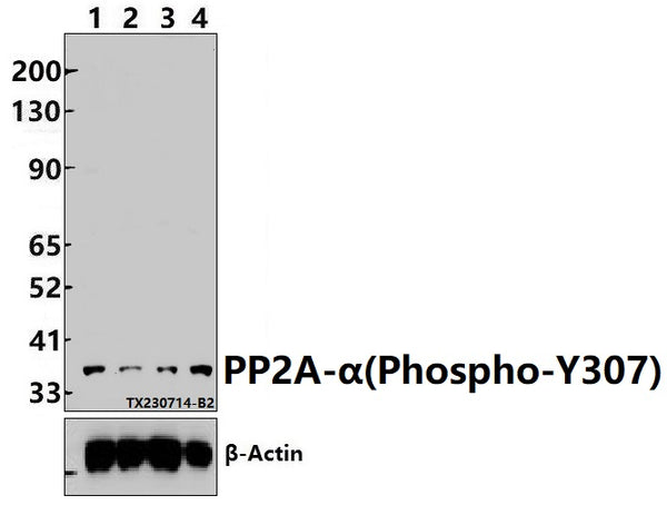 PP2A-α (Phospho-Y307) polyclonal antibody – Figure 1 of 1