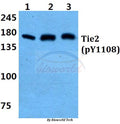 Western blot (WB) analysis of p-Tie-2 (Y1108) polyclonal antibody at 1:500 dilution
Lane1:MCF-7 cell lysate treated with PMA(100nM,15mins)
Lane2:Mouse brain tissue lysate
Lane3:Rat brain tissue lysate