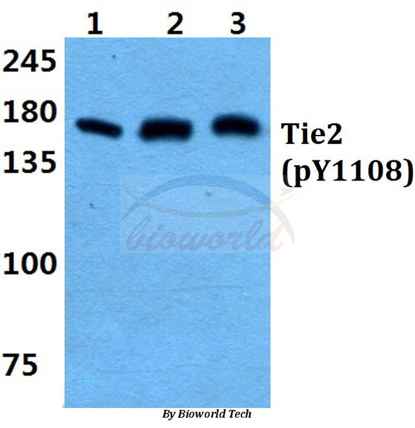 Western blot (WB) analysis of p-Tie-2 (Y1108) polyclonal antibody at 1:500 dilution
Lane1:MCF-7 cell lysate treated with PMA(100nM,15mins)
Lane2:Mouse brain tissue lysate
Lane3:Rat brain tissue lysate