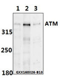 ATM (Phospho-S1981) polyclonal antibody – Figure 1 of 1