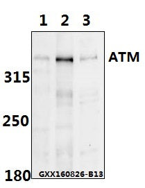 ATM (Phospho-S1981) polyclonal antibody – Figure 1 of 1