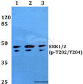 Western blot (WB) analysis of p-ERK1/2 (T202/Y204) polyclonal antibody at 1:500 dilution
Lane1:HEK293T whole cell lysate treated with UV(4h)
Lane2:Raw264.7 whole cell lysate treated with UV(4h)
Lane3:PC12 whole cell lysate treated with UV(4h)