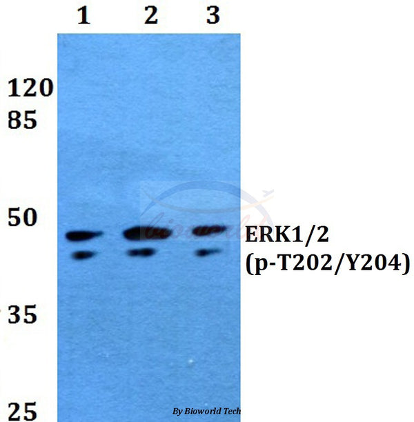 Western blot (WB) analysis of p-ERK1/2 (T202/Y204) polyclonal antibody at 1:500 dilution
Lane1:HEK293T whole cell lysate treated with UV(4h)
Lane2:Raw264.7 whole cell lysate treated with UV(4h)
Lane3:PC12 whole cell lysate treated with UV(4h)