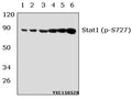Western blot (WB) analysis of Stat1 (phospho-S727) polyclonal antibody at 1:500 dillution
Lane1:NIH-3T3 whole cell lysate(40μg)
Lane2:NIH-3T3 treated with UV(4h) whole cell lysate(40μg)
Lane3:NIH-3T3 treated with PMA(60ng/ml, 30min) whole cell lysate(40μg)
Lane4:Hela whole cell lysate(40μg)
Lane5:Hela treated with IFN-γ(100ng/ml, 15min) whole cell lysate(40μg)
Lane6:Hela treated with PMA(60ng/ml, 30min) whole cell lysate(40μg)