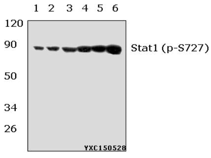 Western blot (WB) analysis of Stat1 (phospho-S727) polyclonal antibody at 1:500 dillution
Lane1:NIH-3T3 whole cell lysate(40μg)
Lane2:NIH-3T3 treated with UV(4h) whole cell lysate(40μg)
Lane3:NIH-3T3 treated with PMA(60ng/ml, 30min) whole cell lysate(40μg)
Lane4:Hela whole cell lysate(40μg)
Lane5:Hela treated with IFN-γ(100ng/ml, 15min) whole cell lysate(40μg)
Lane6:Hela treated with PMA(60ng/ml, 30min) whole cell lysate(40μg)