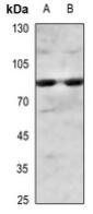 IKKα/β (Phospho-S180/181) polyclonal antibody – Figure 1 of 1