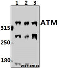 Western blot (WB) analysis of ATM (I1987) pAb at 1:500 dilution
Lane1:HEK293T whole cell lysate(40ug)
Lane2:L02 whole cell lysate(40ug)
Lane3:H1792 whole cell lysate(40ug)