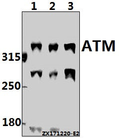 Western blot (WB) analysis of ATM (I1987) pAb at 1:500 dilution
Lane1:HEK293T whole cell lysate(40ug)
Lane2:L02 whole cell lysate(40ug)
Lane3:H1792 whole cell lysate(40ug)