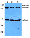 Western blot (WB) analysis of VWA5A polyclonal antibody at 1:500 dilution
Lane1:Hela cell lysate
Lane2:NIH-3T3 cell lysate
Lane3:H9C2 cell lysate